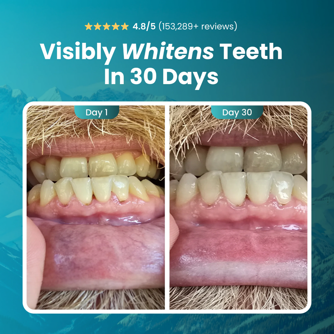 RevineCo - Remineralizing Gum